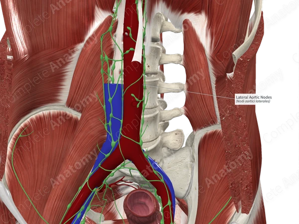 Lateral Aortic Nodes