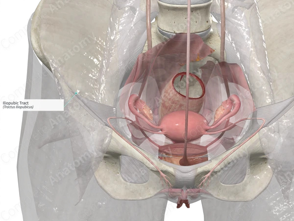 Iliopubic Tract 