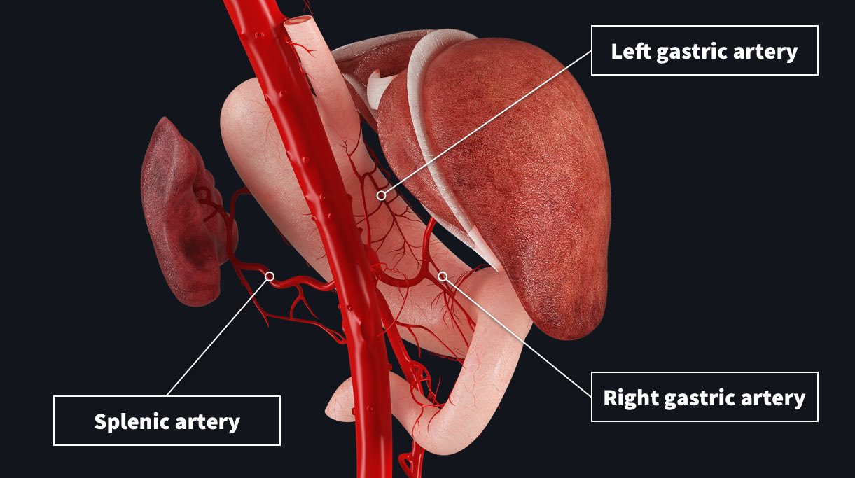 Lesser curvature of the stomach with attached left gastric artery, right gastric artery and splenic artery showing arterial supply to the stomach region