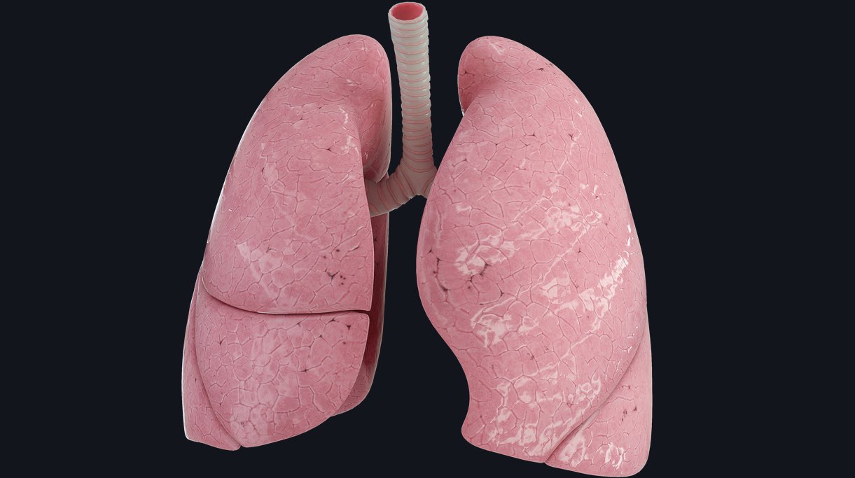 Lung anatomy showing the right upper lobe, right middle lobe, right lower lobe, left upper lobe and left lower lobe