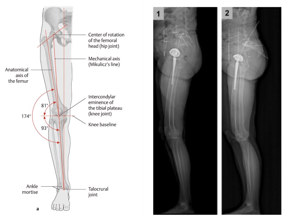 Detailed bone measurements