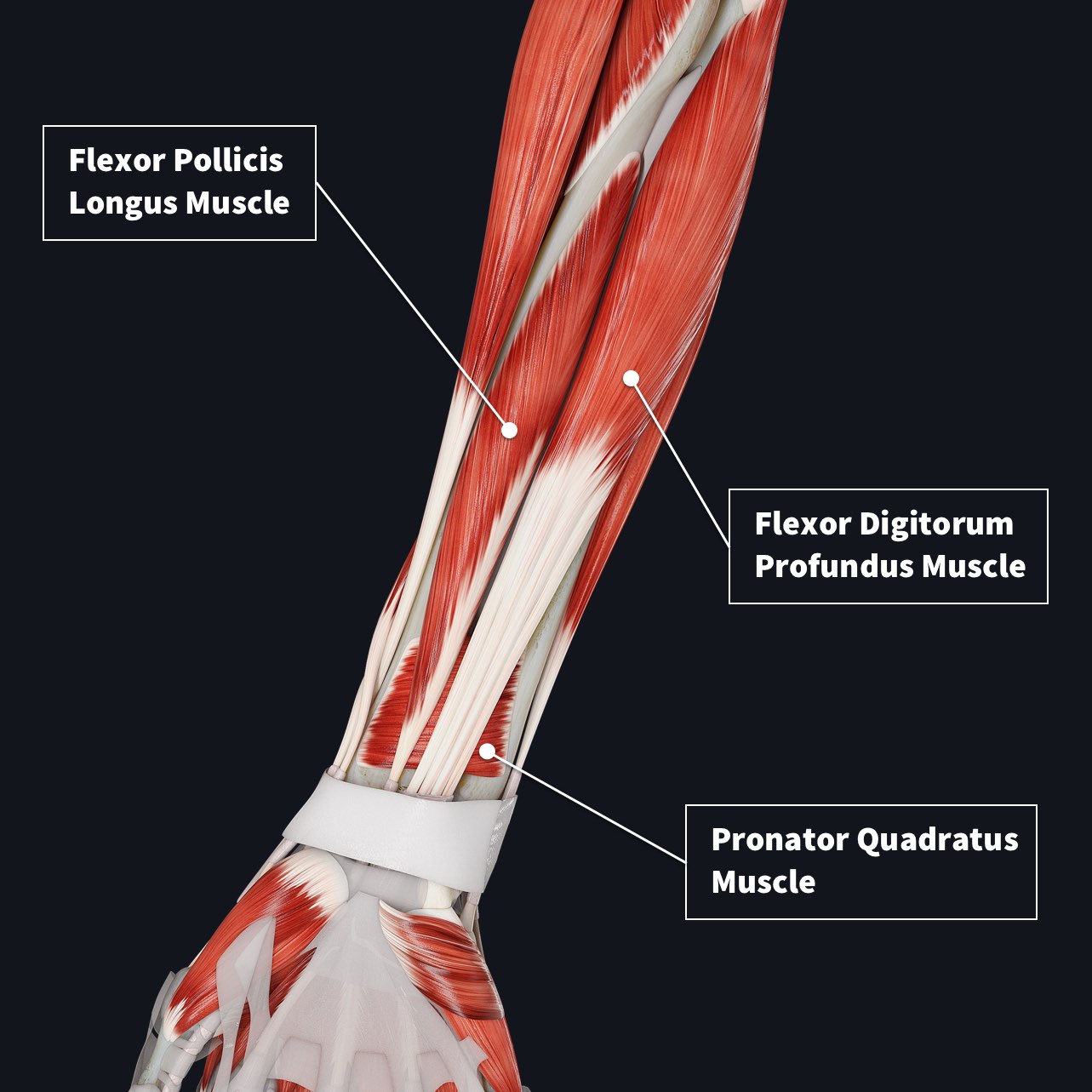 The anterior compartment of the forearm showing the deep muscles including the Flexor Pollicis Longus, Flexor Digitorum Profundus and the Pronator Quadratus