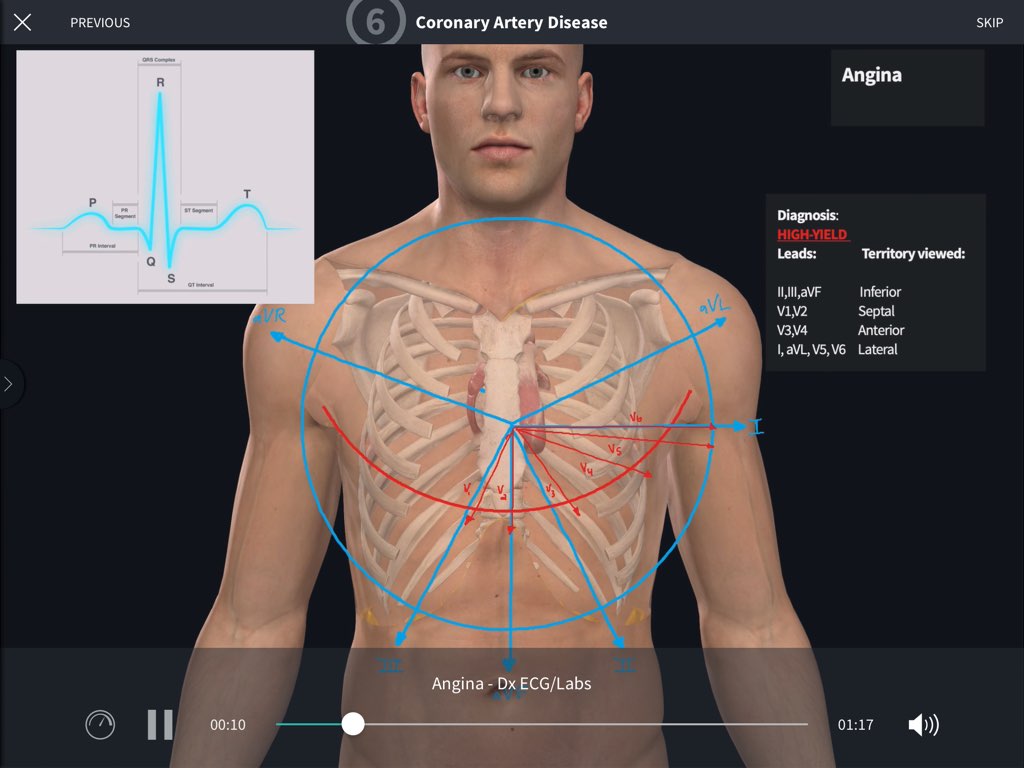 Cardiovascular Surgery: One of the Courses on the Complete Anatomy platform
