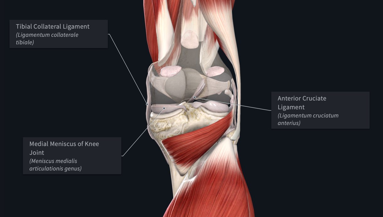 ACL (Anterior Cruciate Ligament) MCL (Medial Collateral Ligament) Tear and  Repair - 3D Animation 