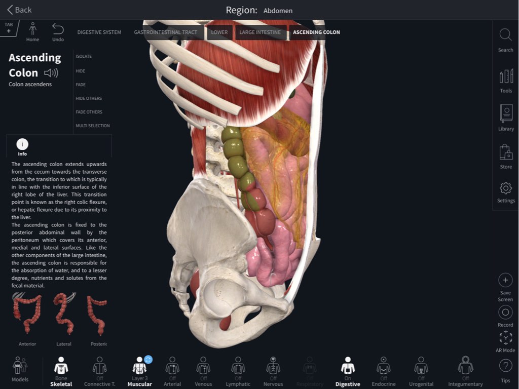 3d4medical download complete anatomy