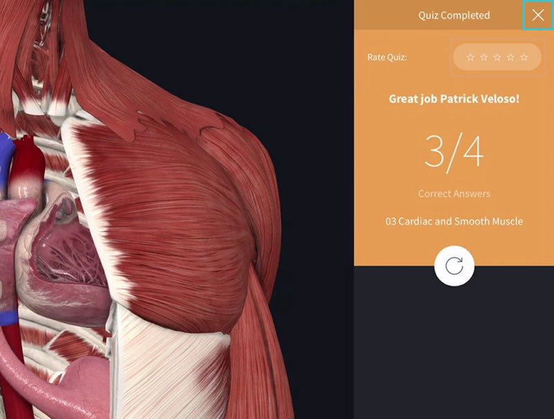 custom quizes essential anatomy 3