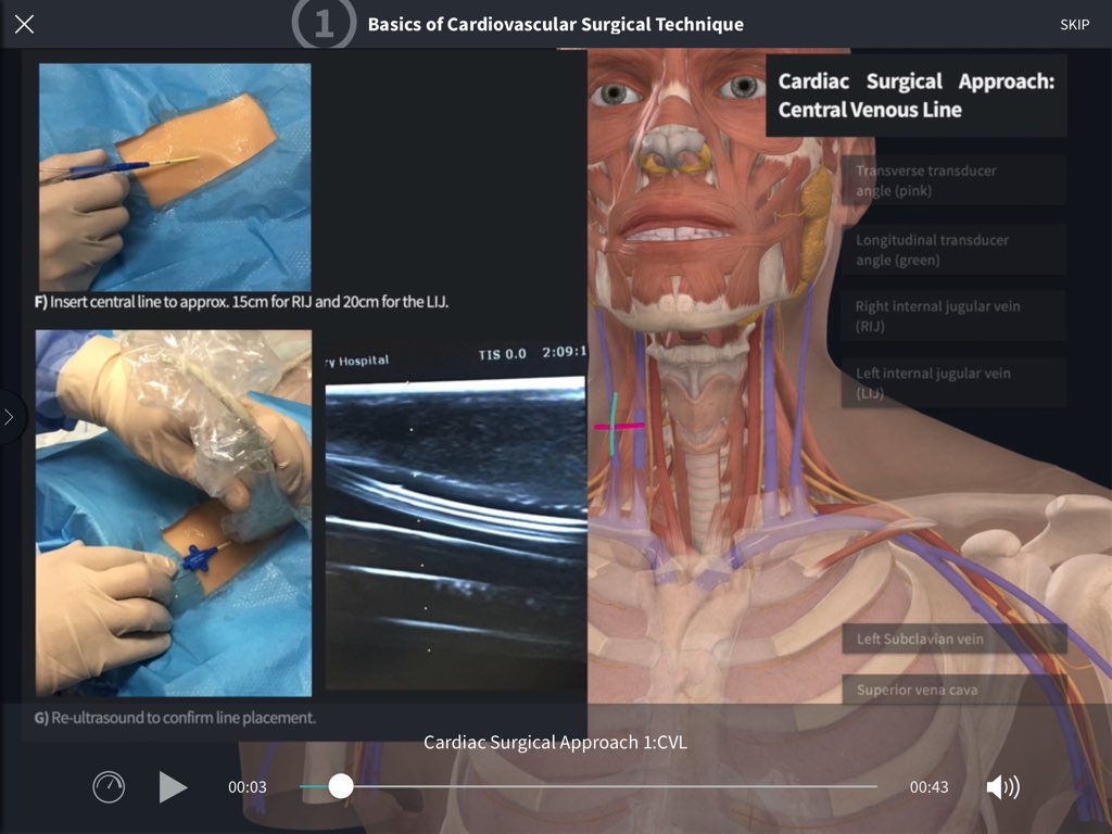 健康・医学 Fundamentals of Cardiovascular Surgery 健康・医学 Fundamentals of Cardiovascular Surgery