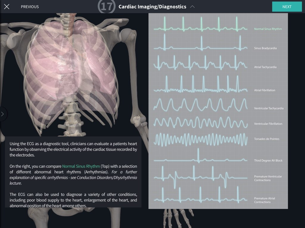 Cardiology / Cardiovascular Surgery - Complete Anatomy