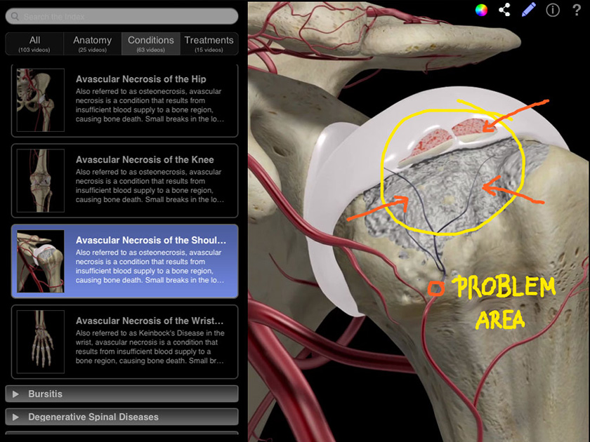 Orthopedic Patient Education