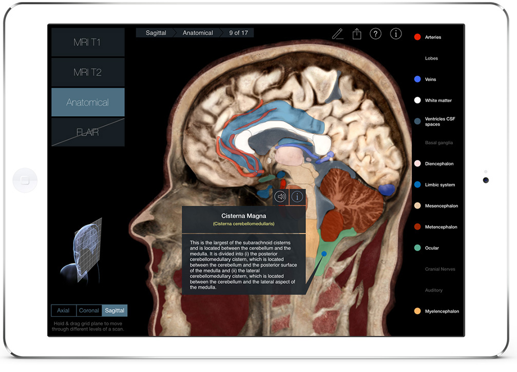 hippocampus anatomy landmarks