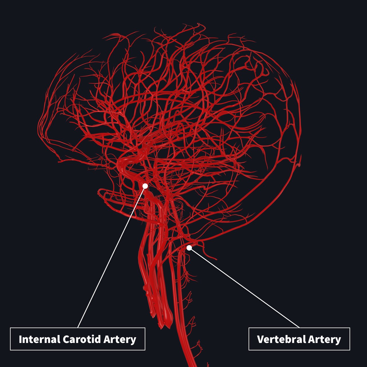 Blood supply to the brain with internal carotid artery and vertebral artery highlighted