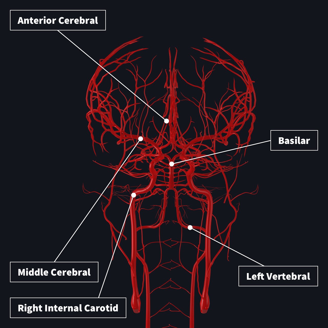Blood supply to the brain with anterior cerebral artery, basilar artery, middle cerebral artery, left vertebral artery and right internal carotid artery highlighted