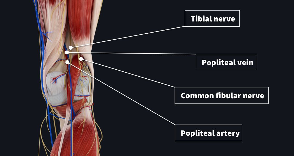 The popliteal fossa with popliteal artery, tibial nerve, popliteal vein and common fibular nerve labelled