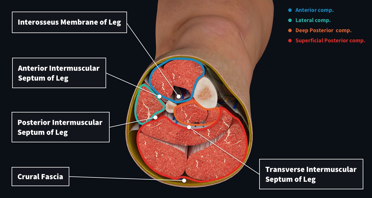 Cross section of the leg showing the muscles of the anterior compartment, lower compartment, deep posterior compartment and superficial posterior compartment
