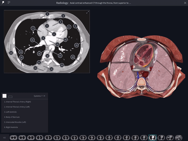 Interactive Radiology Images