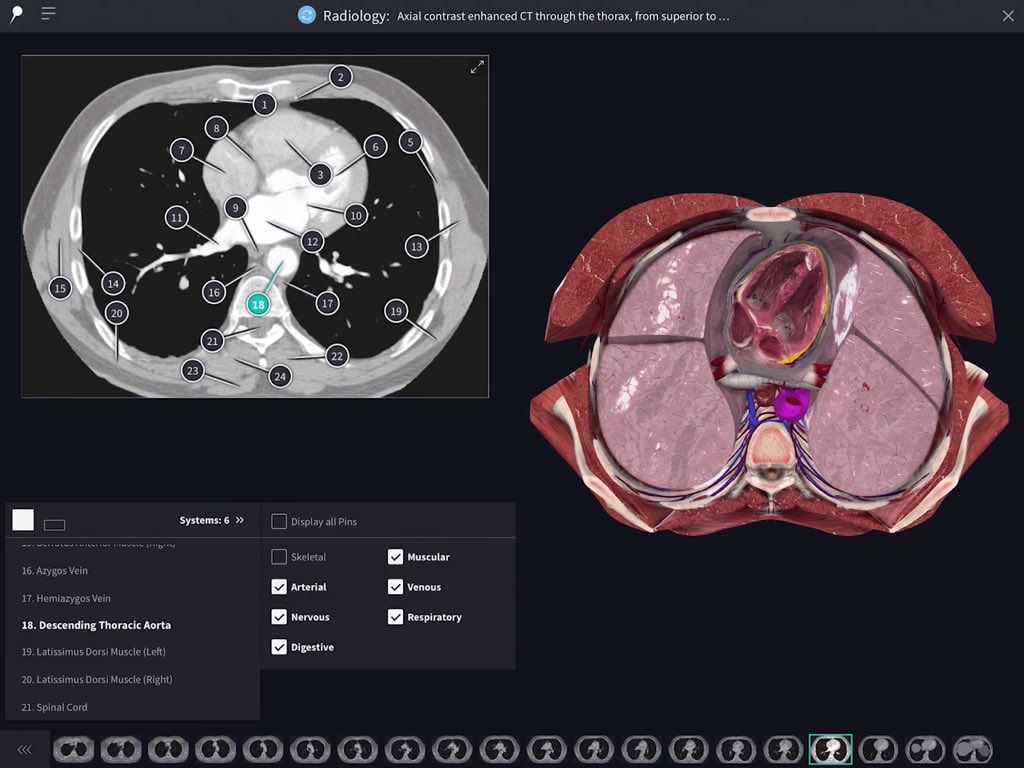 radiology images